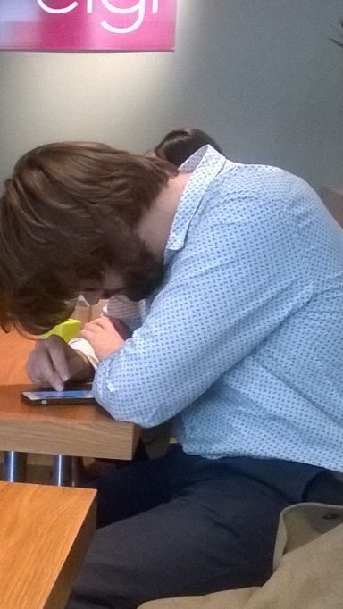Déformation du dos avec scoliose avancée sur un jeune necessitant de la rééducation posturale